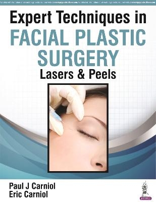 Expert Techniques in Facial Plastic Surgery - Paul J Carniol, Eric Carniol