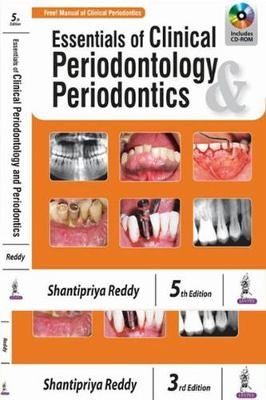 Essentials of Clinical Periodontology & Periodontics - Shantipriya Reddy