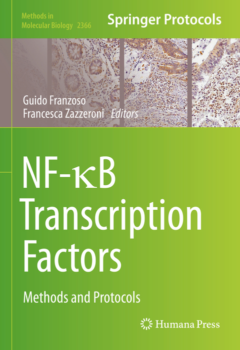 NF-κB Transcription Factors - 