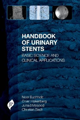 Handbook of Urinary Stents - Noor Buchholz, Oliver Hakenberg, Junaid Masood, Christian Bach