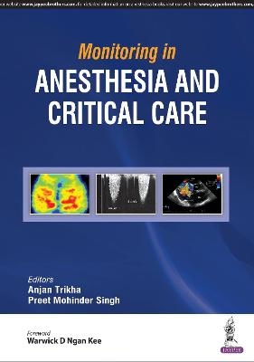 Monitoring in Anesthesia and Critical Care - Anjan Trikha, Preet Mohinder Singh