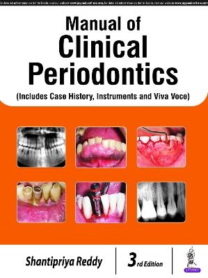 Manual of Clinical Periodontics - Shantipriya Reddy