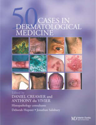 Fifty Dermatological Cases -  Daniel Creamer,  Anthony du Vivier