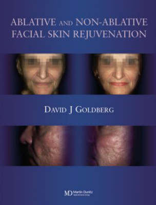 Ablative and Non-ablative Facial Skin Rejuvenation -  David J. Goldberg