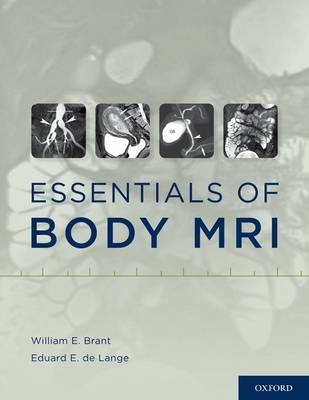 Essentials of Body MRI - 