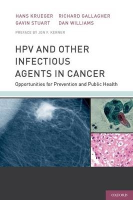 HPV and Other Infectious Agents in Cancer -  Richard Gallagher,  Hans Krueger,  Gavin Stuart,  Dan Williams
