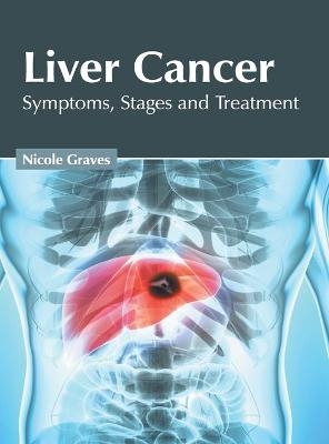 Liver Cancer: Symptoms, Stages and Treatment - 