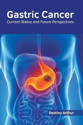 Gastric Cancer: Current Status and Future Perspectives - 