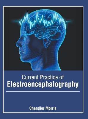 Current Practice of Electroencephalography - 