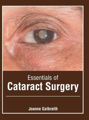 Essentials of Cataract Surgery - J Galbraith