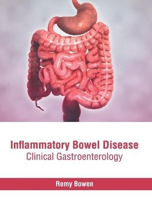 Inflammatory Bowel Disease: Clinical Gastroenterology - 