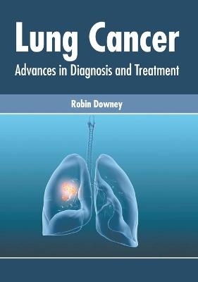 Lung Cancer: Advances in Diagnosis and Treatment - 