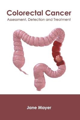 Colorectal Cancer: Assessment, Detection and Treatment - 