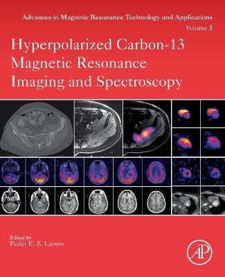 Hyperpolarized Carbon-13 Magnetic Resonance Imaging and Spectroscopy - 