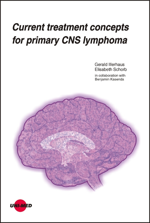 Current treatment concepts for primary CNS lymphoma - Gerald Illerhaus, Elisabeth Schorb