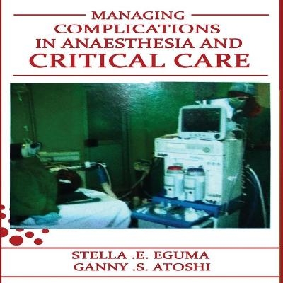 Management of Complications in Anaesthesia and Critical Care - Stella Eguma, Atoshi S Ganny