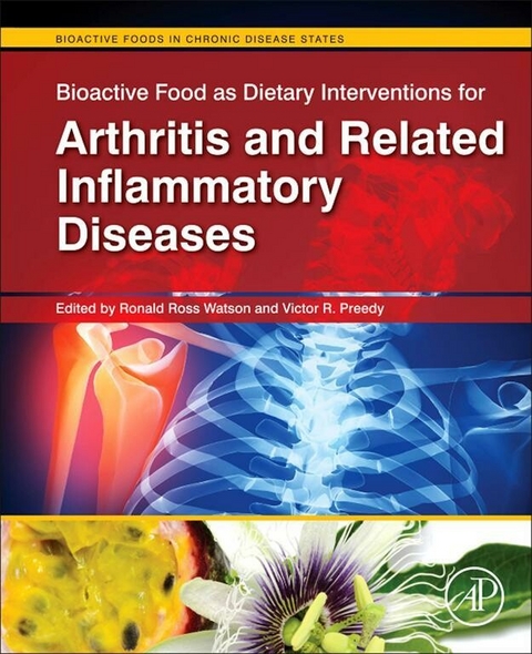Bioactive Food as Dietary Interventions for Arthritis and Related Inflammatory Diseases - 