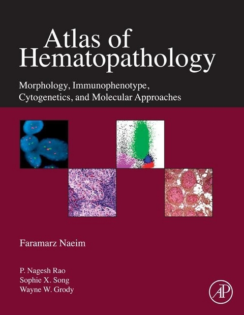 Atlas of Hematopathology -  Faramarz Naeim,  P. Nagesh Rao,  Sophie Song,  Wayne W. Grody