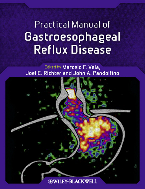 Practical Manual of Gastroesophageal Reflux Disease - 