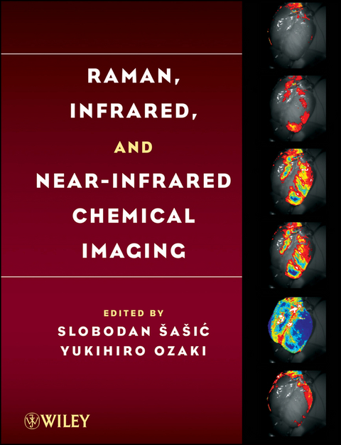 Raman, Infrared, and Near-Infrared Chemical Imaging - 