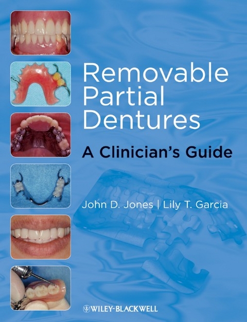 Removable Partial Dentures -  John D. Jones,  Lily T. Garc a