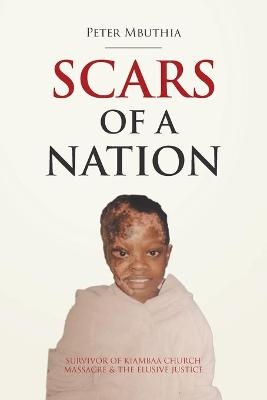 Scars of a Nation - Peter Mbuthia