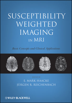 Susceptibility Weighted Imaging in MRI - 