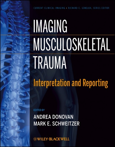 Imaging Musculoskeletal Trauma - 