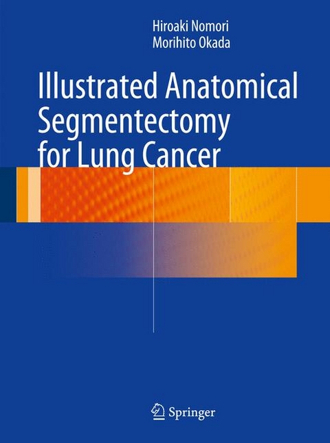 Illustrated Anatomical Segmentectomy for Lung Cancer -  Hiroaki Nomori,  Morihito Okada