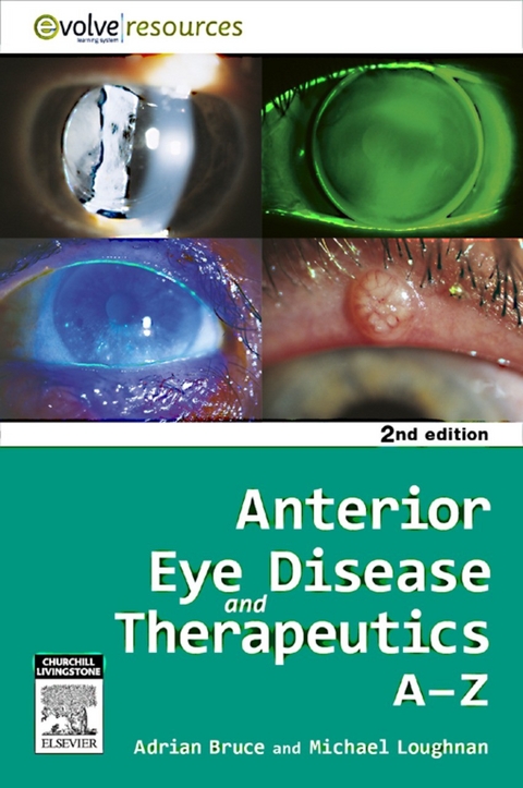 Anterior Eye Disease and Therapeutics A-Z - E-Book -  Adrian S. Bruce,  Michael Stephen Loughnan