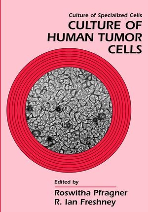Culture of Human Tumor Cells - 