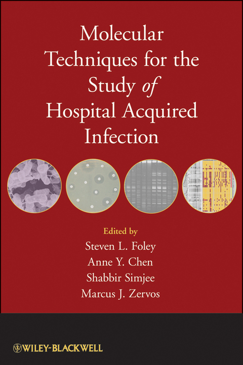 Molecular Techniques for the Study of Hospital Acquired Infection - 