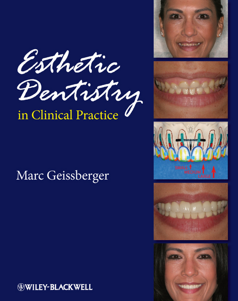 Esthetic Dentistry in Clinical Practice -  Marc Geissberger