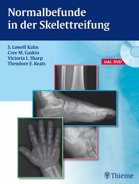 Normalbefunde in der Skelettreifung -  S. Lowell Kahn,  Cree M. Gaskin,  Victoria L. Sharp,  Theodore E. Keats