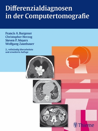 Differenzialdiagnosen in der Computertomografie - Francis A. Burgener; Christopher Herzog; Steven Meyers …