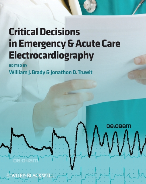 Critical Decisions in Emergency and Acute Care Electrocardiography - 