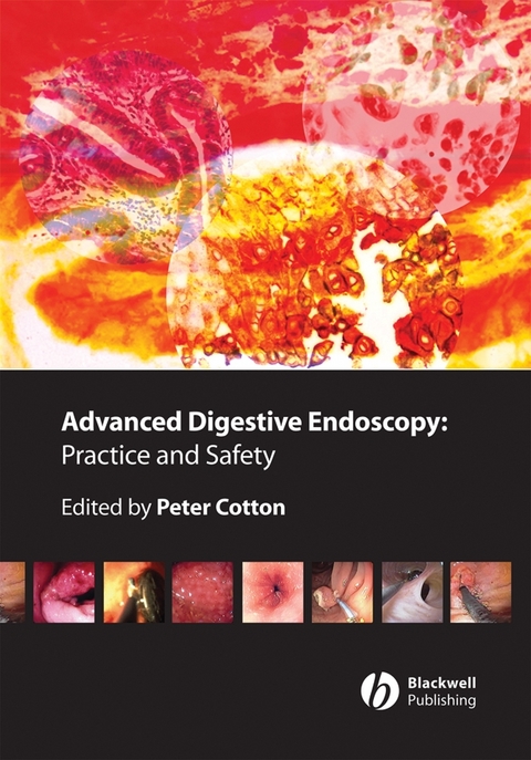 Advanced Digestive Endoscopy - 