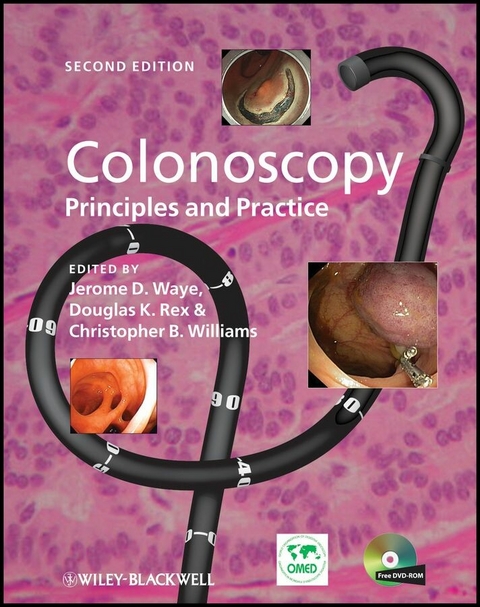 Colonoscopy - 