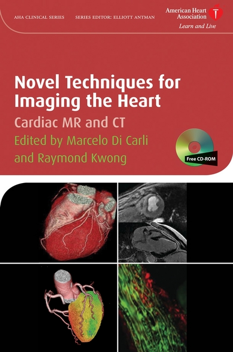 Novel Techniques for Imaging the Heart - 