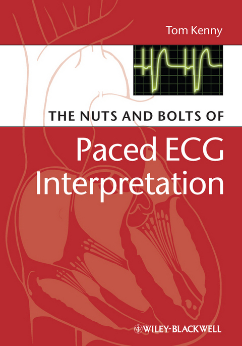 Nuts and bolts of Paced ECG Interpretation -  Tom Kenny