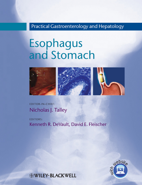 Practical Gastroenterology and Hepatology - 