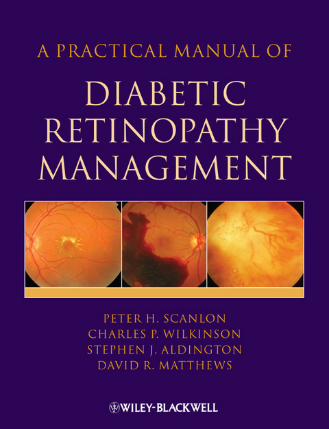 Practical Manual of Diabetic Retinopathy Management -  Stephen Aldington,  David Matthews,  Peter H. Scanlon,  Charles Wilkinson