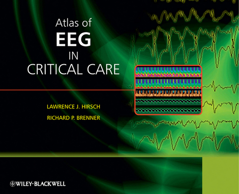 Atlas of EEG in Critical Care - 