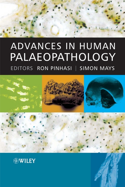 Advances in Human Palaeopathology - 