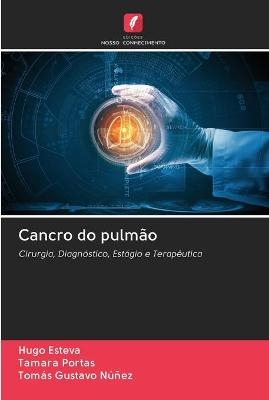 Cancro do pulmão - Hugo Esteva, Tamara Portas, Tomás Gustavo Núñez