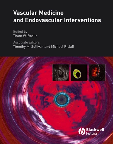 Vascular Medicine and Endovascular Interventions - 