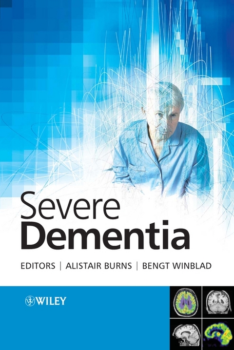 Severe Dementia - 