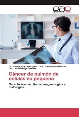 Cáncer de pulmón de células no pequeña - Dr Euridys Mauri Rodríguez, Dra Daivis Machado Lores, Dra Leiry Garriga Guevara