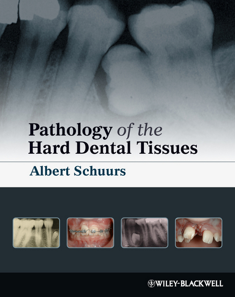 Pathology of the Hard Dental Tissues -  Albert Schuurs