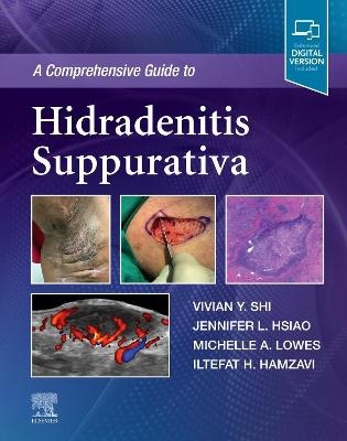 A Comprehensive Guide to Hidradenitis Suppurativa - Vivian Y. Shi, Jennifer L. Hsiao, Michelle A. Lowes, Iltefat H. Hamzavi